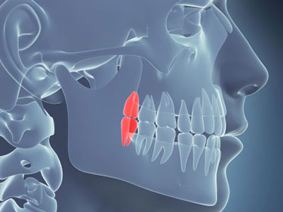 Wisdom teeth graphic